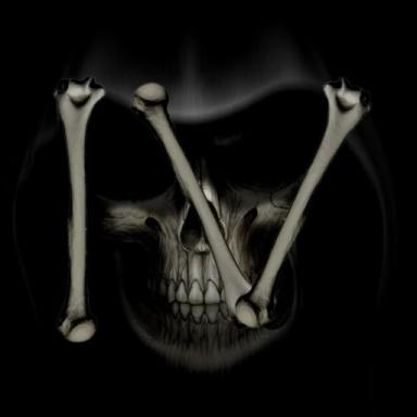 Thumbnail for Competitive Broken Bones IV Game